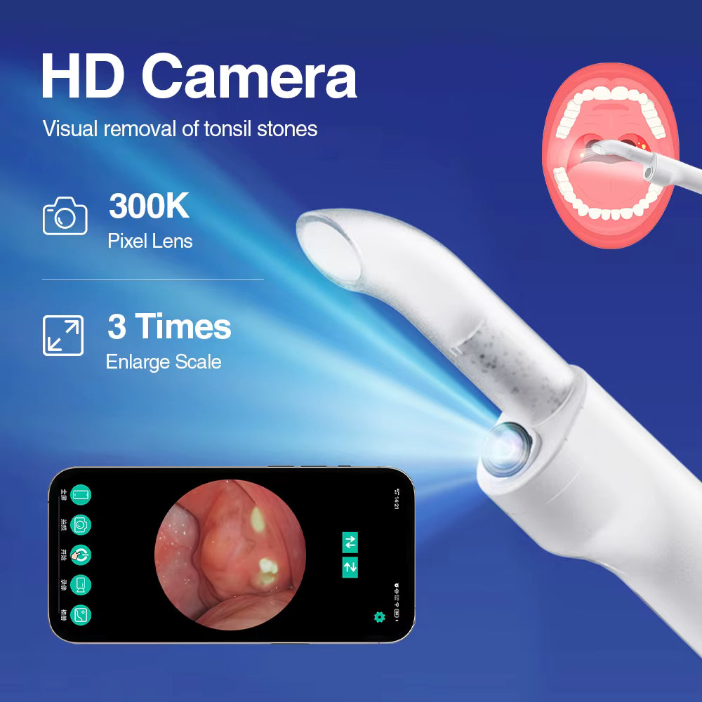 Electric Tonsil Stone Remover: Painless HD View