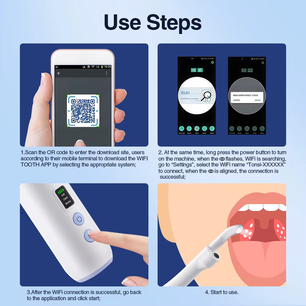 Electric Tonsil Stone Remover: Painless HD View